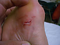 gash